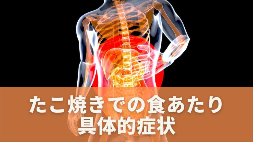 たこ焼きで食あたりは起こる？生焼けのサインは？